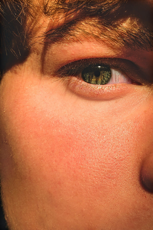 Dry vs Dehydrated Skin